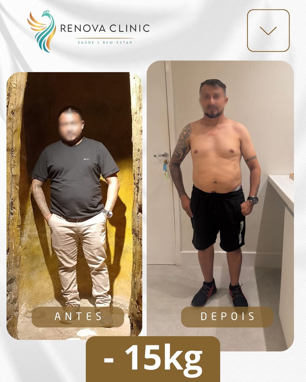 -15kg Emagrecimento Renova Clinic São Luís
