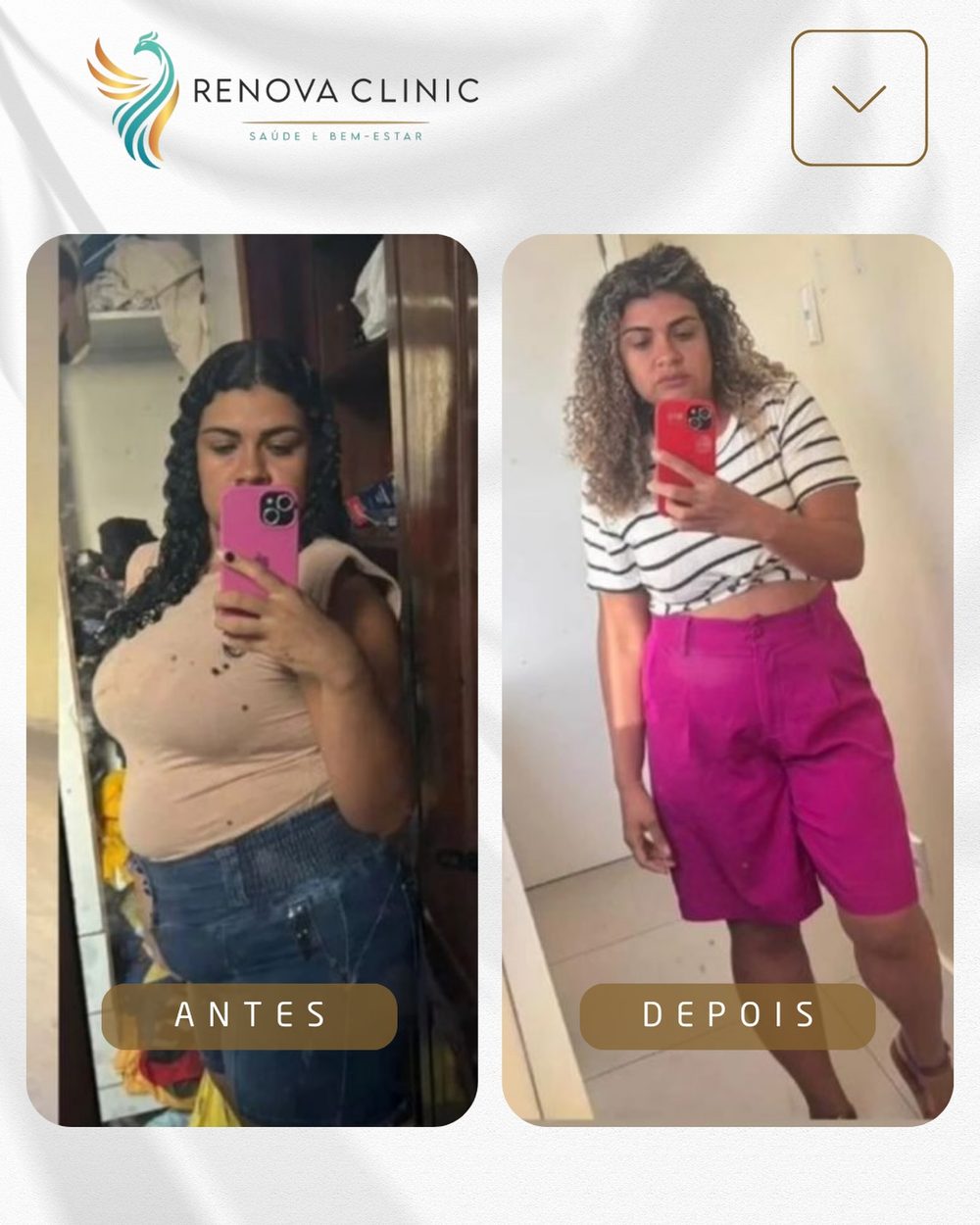 Resultado real Renova Clinic São Luís